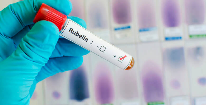Bangla Govt to start measles rubella vaccination (MRV) programme